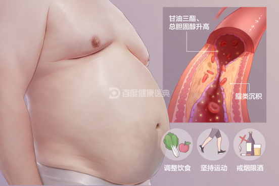 慢性病你关注过吗