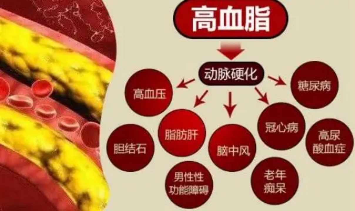慢病表现形式,您清楚吗?(三) 慢病表现形式,您清楚吗?(三)