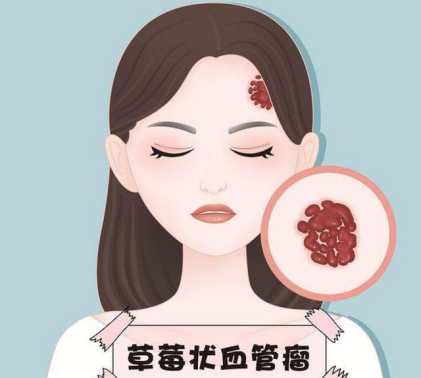 血管健康的意义(二) 血管健康的意义(二)