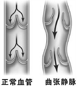 血管健康的意义(二) 血管健康的意义(二)