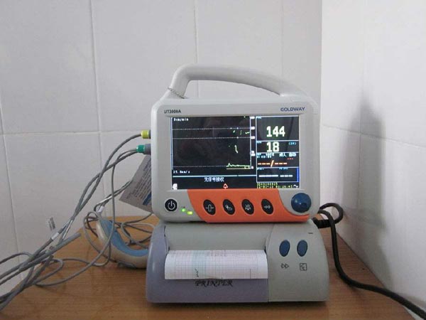 胎心监护仪具有哪些突出优势 胎心监护仪具有哪些突出优势